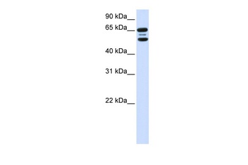 FBXO21 Antibody