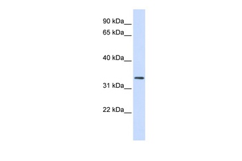 FBXO25 Antibody