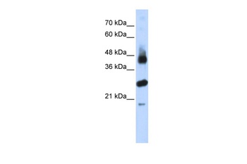 FBXL2 Antibody