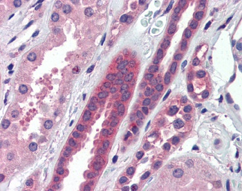 ATP6V0A2 Antibody