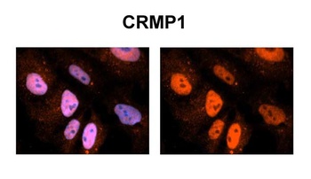 CRMP1 Antibody
