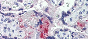 F2 Antibody