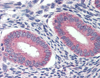 GRHL2 Antibody