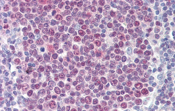 TGFB1I1 Antibody