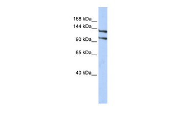 RBM5 Antibody