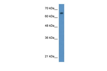 WT1 Antibody