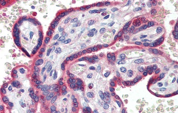 ZNF165 Antibody