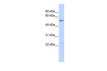 TRIM35 Antibody