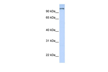 PARP9 Antibody