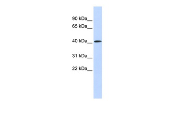 PARP11 Antibody