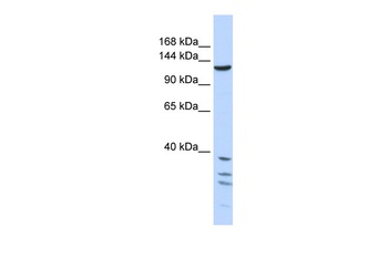 TNKS Antibody