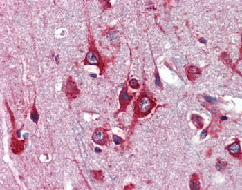 TFAP2C Antibody