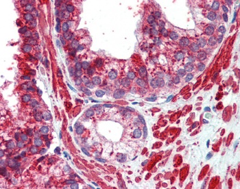 TFAP2C Antibody