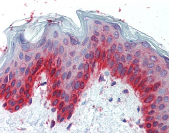 TFAP2C Antibody
