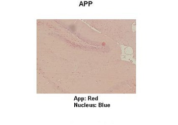 APP Antibody