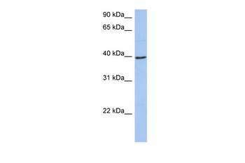 ACADM Antibody