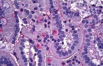 CAM Kinase 1D Antibody