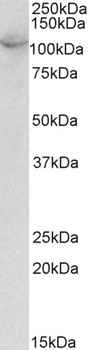 CLIC1 / NCC27 Antibody