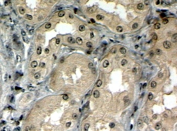 Prune Homolog 2 Antibody