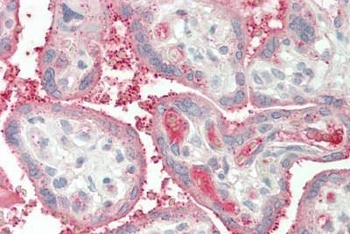 HSPA13 / STCH Antibody