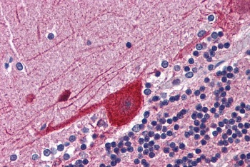 FKBP4 Antibody