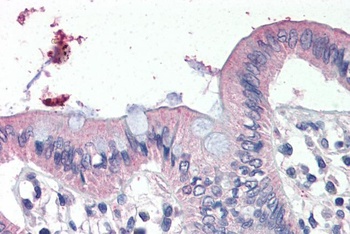 PARP3 Antibody