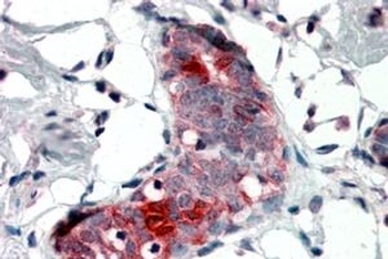 LITAF Antibody
