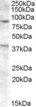 KCNJ11 Antibody