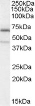 KCNJ11 Antibody