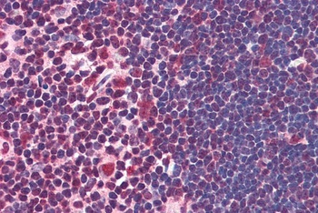 NF45 Antibody