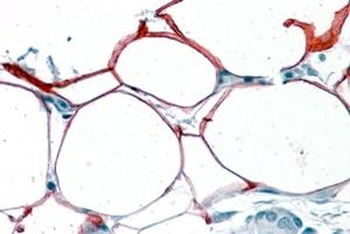 NF45 Antibody