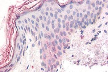 ZIC5 Antibody