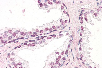 ZIC5 Antibody