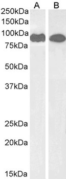 VPS35 Antibody