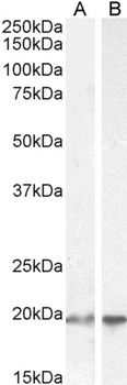 UBCH10 Antibody