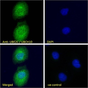UBCH10 Antibody
