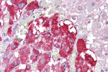 TPTE Antibody
