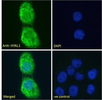 TPD52 Antibody