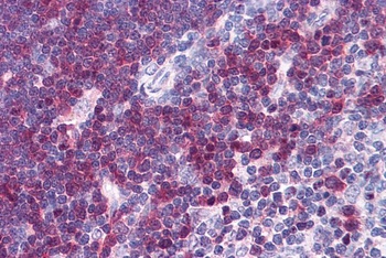 Stathmin 1 Antibody