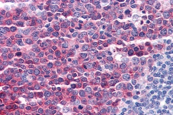 Stathmin 1 Antibody