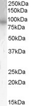 Stathmin 1 Antibody