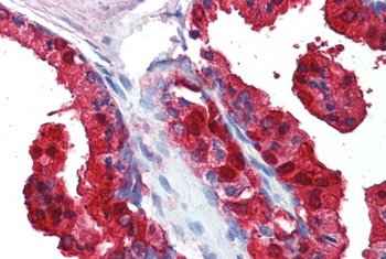 Sorbitol Dehydrogenase Antibody