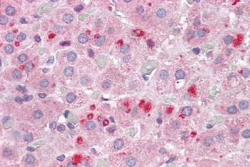 SET Antibody