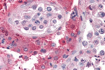SET Antibody