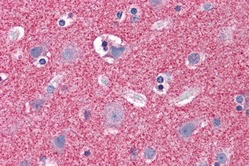 Septin 3 Antibody