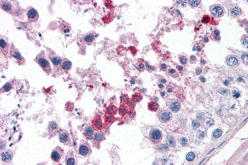 Septin 3 Antibody
