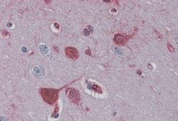 RAE1 Antibody