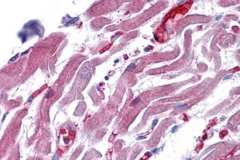 RAE1 Antibody
