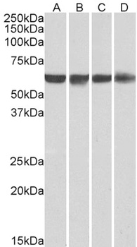 PTB Antibody