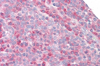 MPS1 Antibody
